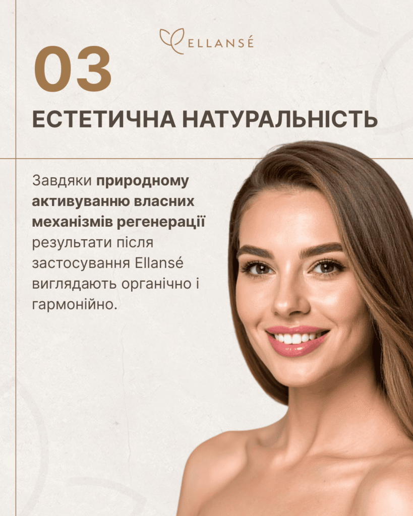 Ellanse-Posty_11_ТОП-4 переваги_4