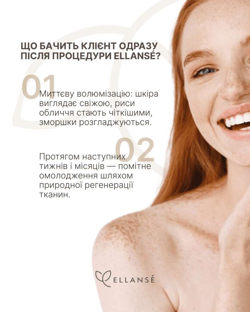 Ellanse-Posty_13_Що таке Ellansé _4