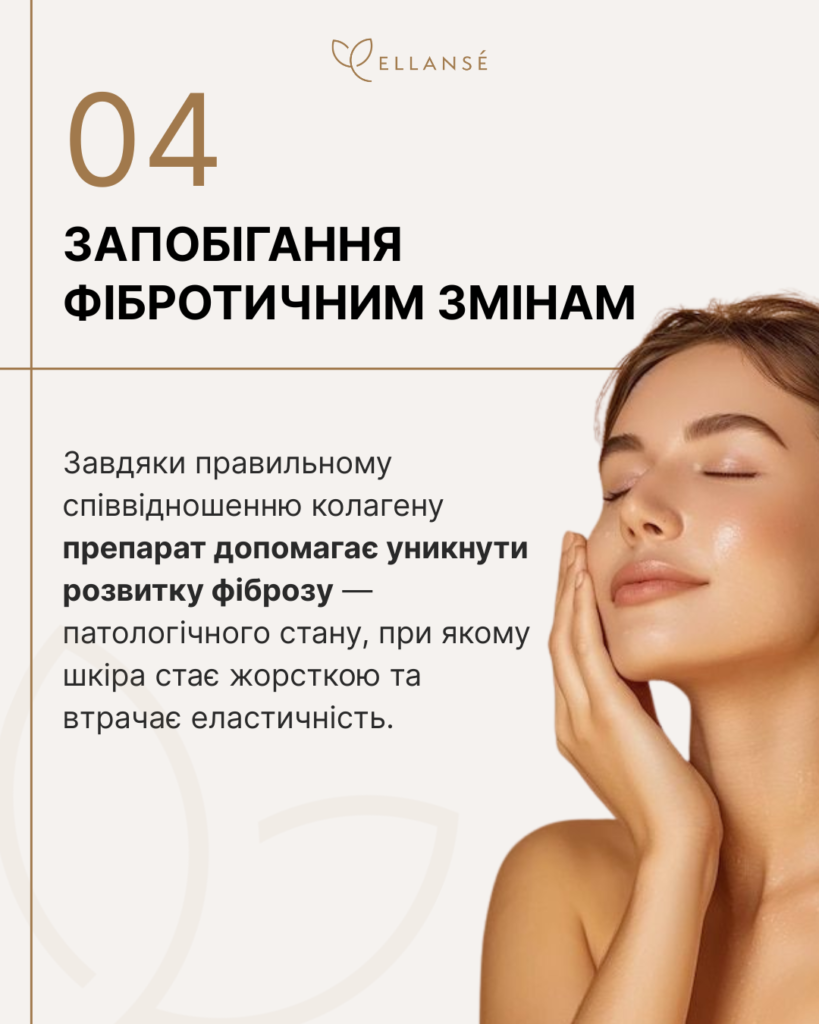 Ellanse-Posty_14_Як працює колагеностимутор_5