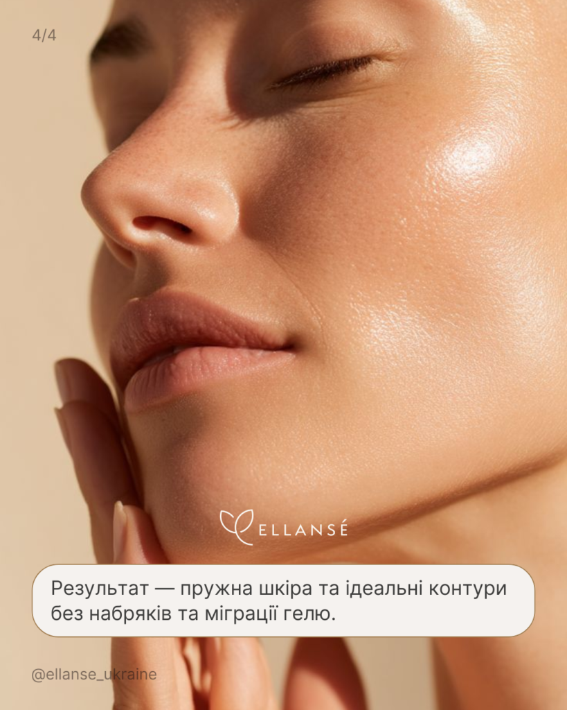 Ellanse-posty_3_4_Vashi_patsiyenty_krasa
