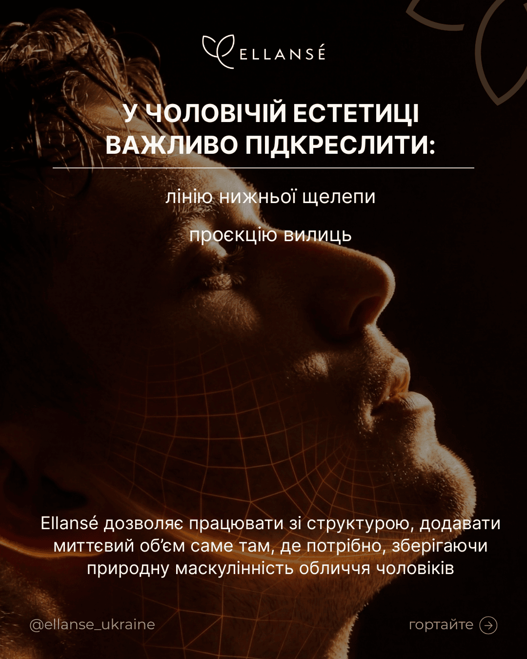 Ellanse-Posty_7_Гармонізація обличчя чоловіків_2