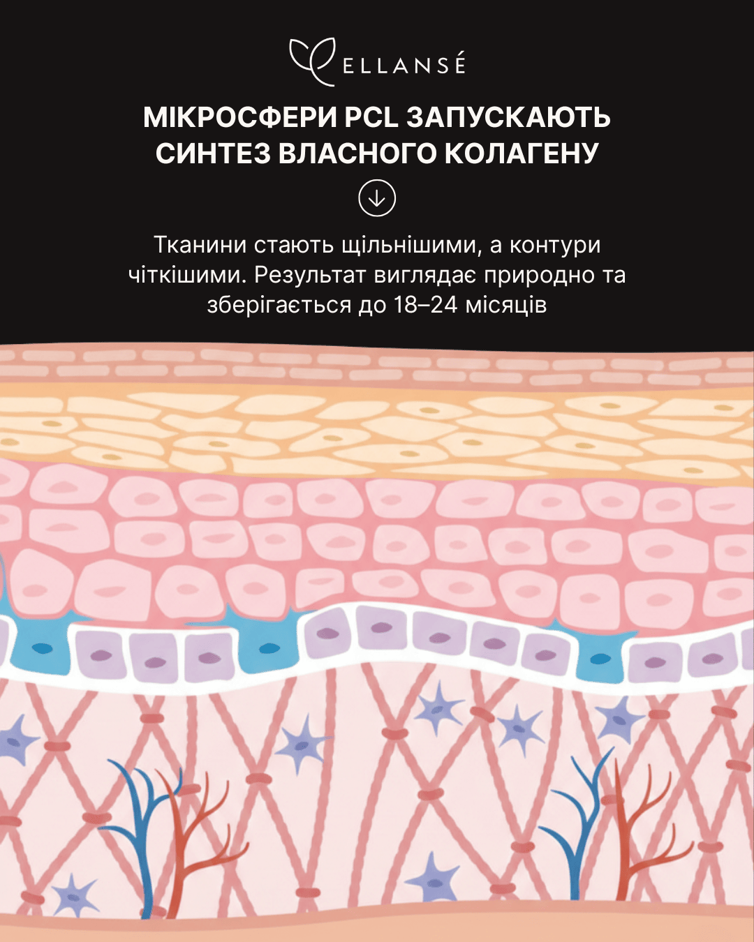 Ellanse-Posty_7_Гармонізація обличчя чоловіків_3